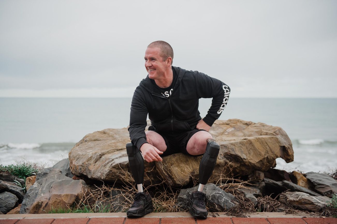 Osseointegration patient Darren, living actively after surgery